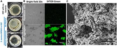 Combining bacteriophage and vancomycin is efficacious against MRSA biofilm-like aggregates formed in synovial fluid